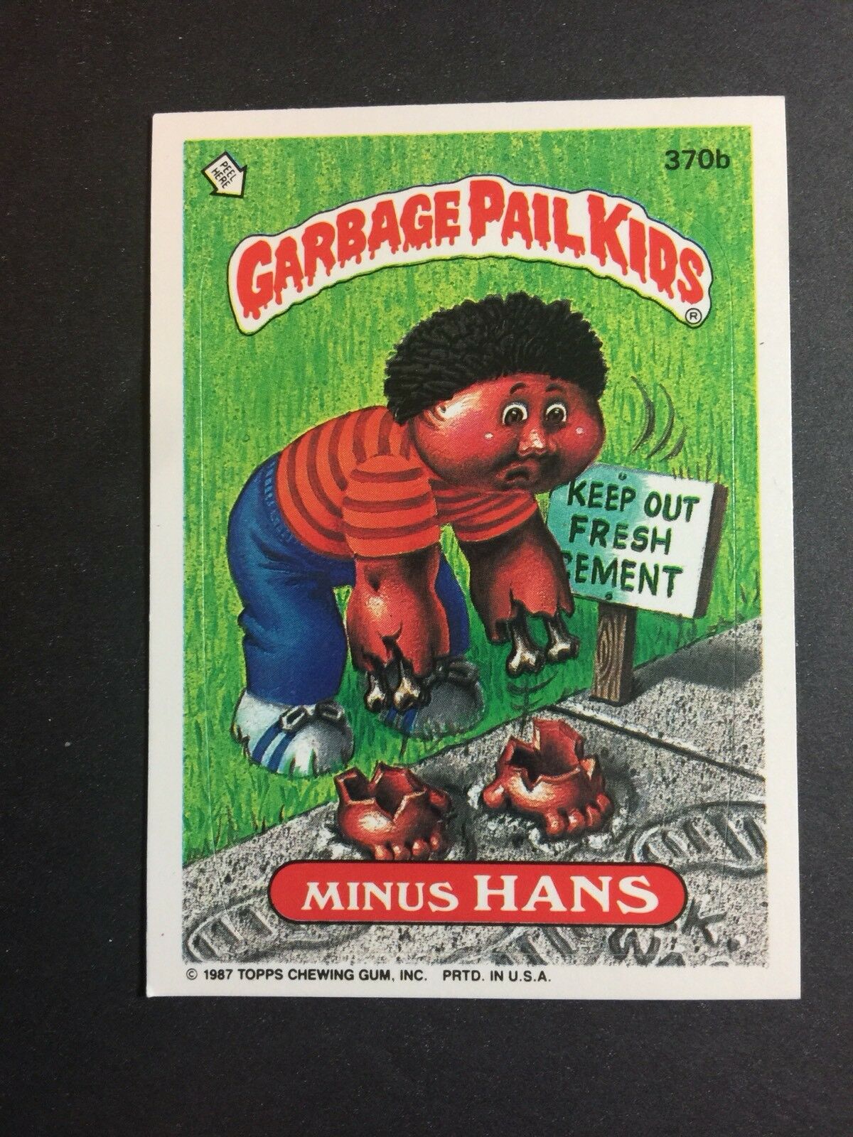 1987 Topps  Garbage Pail Kids Minus Hans Trading Card / Sticker #  370b
