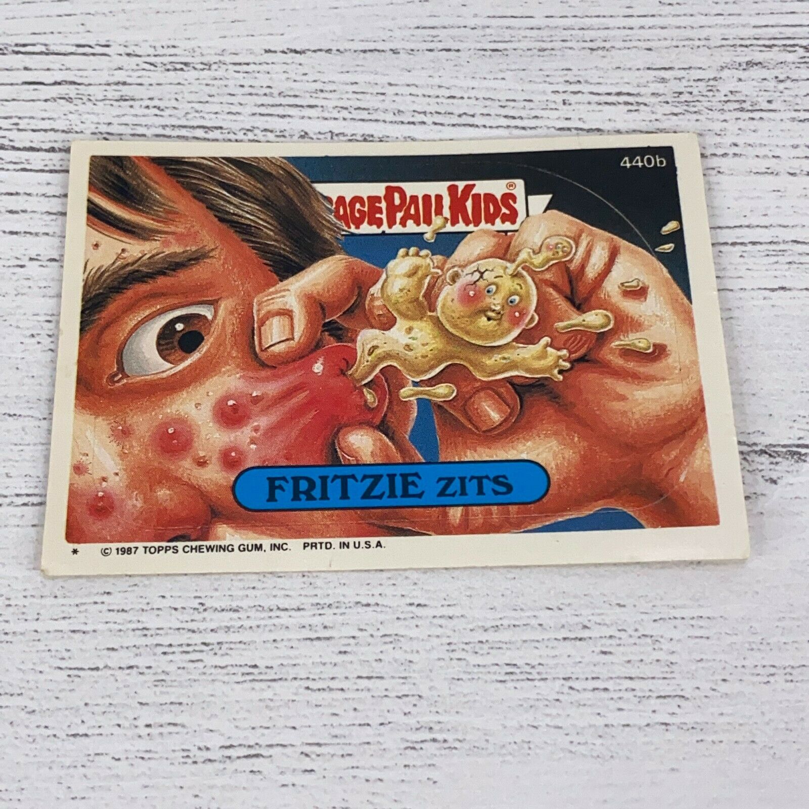 1987 Garbage Pail Kids #440b Fritzie Zits Trading Card Original Series 11 Topps